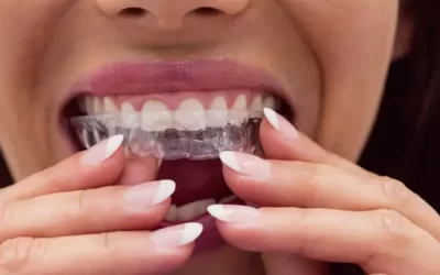 Invisalign Torrance: Clear Aligner Therapy for Discreet Orthodontic Correction